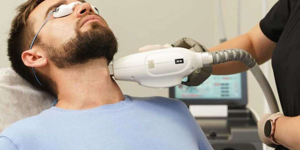 The Best Time to Start Beard Laser Hair Removal Treatment