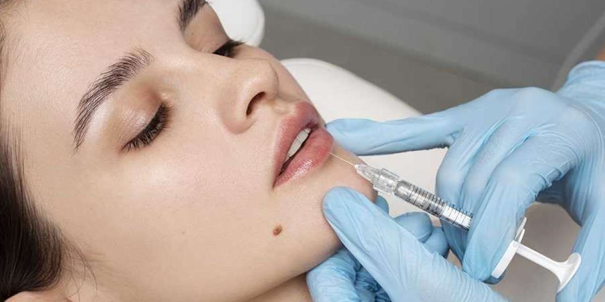 Benefits of Choosing Filler Injections in Dubai