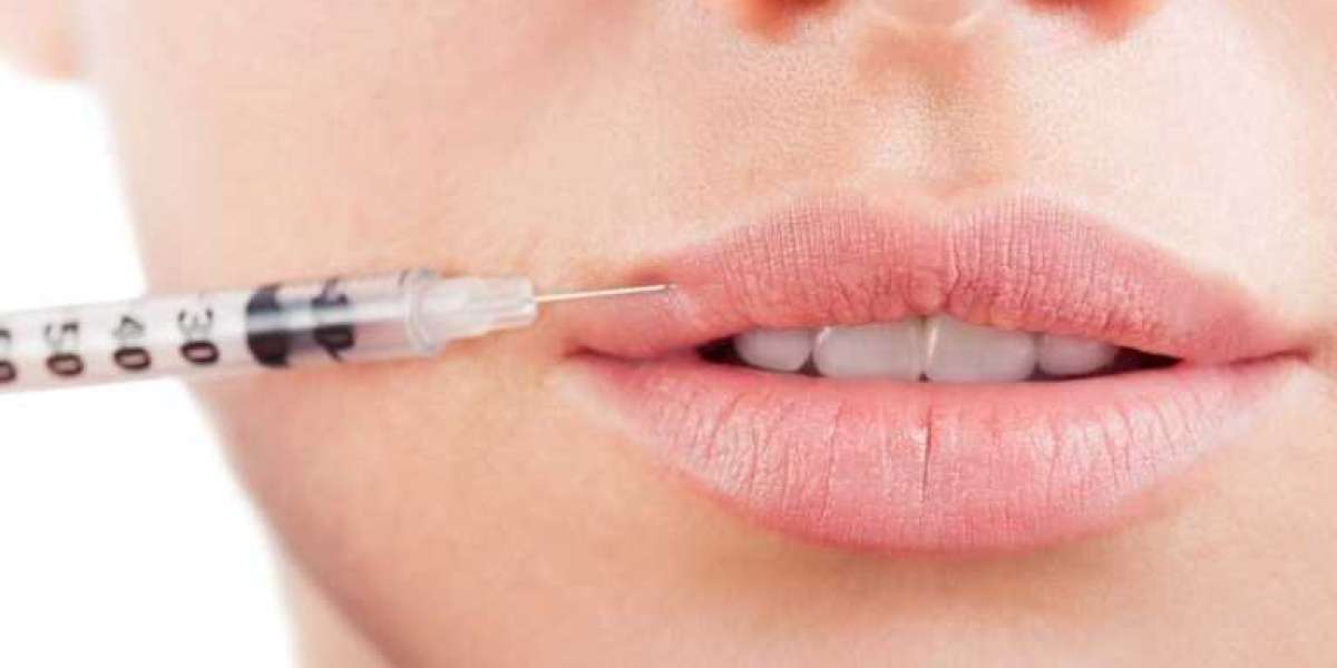 Complete Guide to Lip Fillers in West Palm Beach