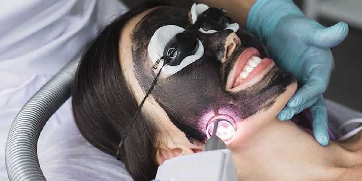 Laser Carbon Peel in Dubai: A Revolutionary Treatment for Radiant and Clear Skin