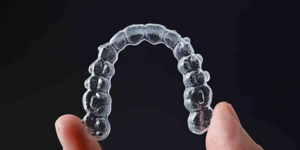 Invisalign or braces: which is best for you?