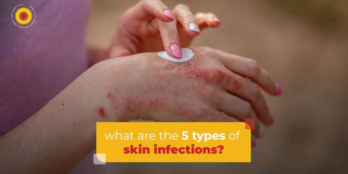 What Are the 5 Types of Skin Infections?