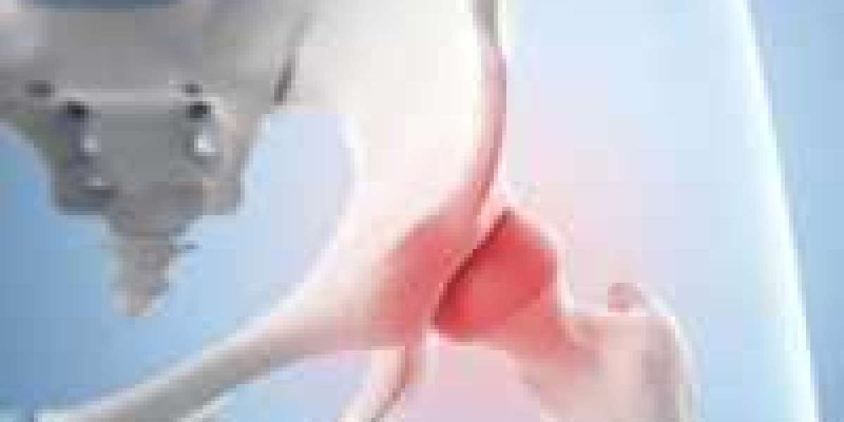 Hip Replacement in Lahore: Trusted Solutions at Ortho Center