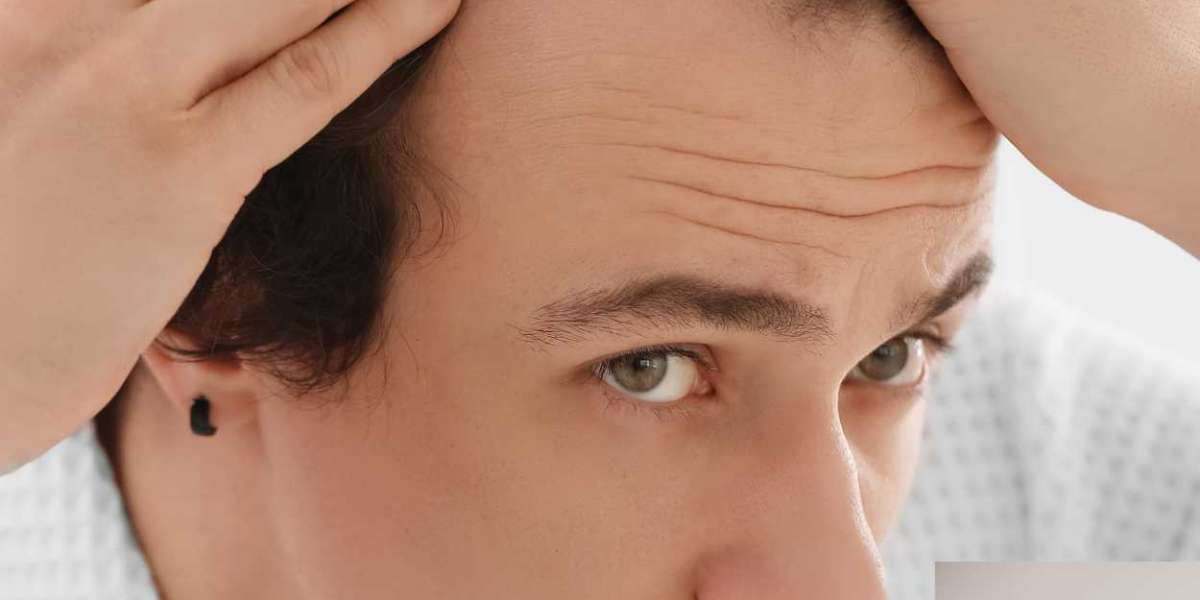 The Science Behind Hair Density: Treatments That Actually Work