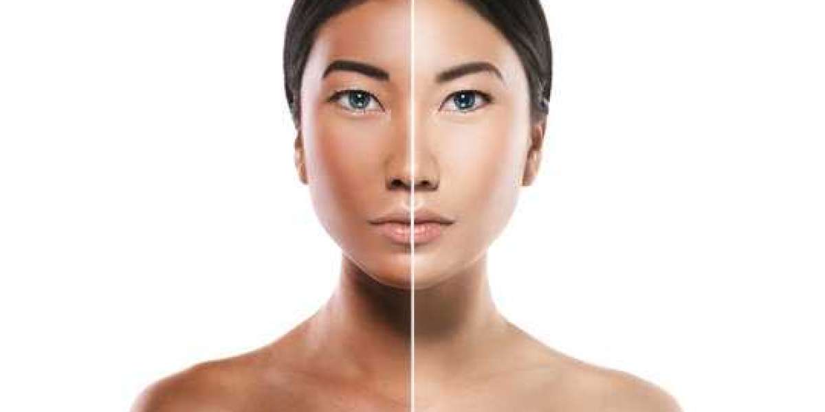 Skin Whitening in Dubai: Trends, Treatments, and Considerations