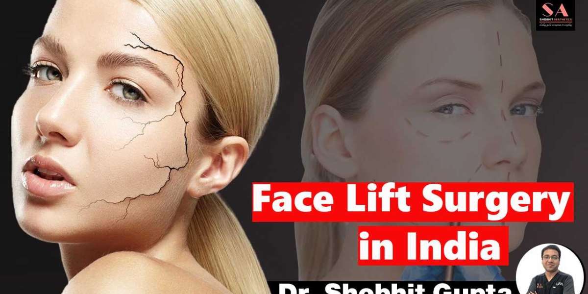 Considering Facelift Surgery in Delhi? Here's Everything You Need to Know About Costs