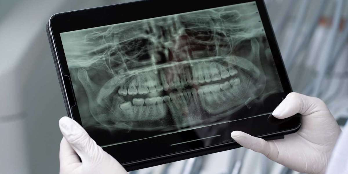 Dental Imaging Market Insights, Trends, and Growth Drivers 2025-2032