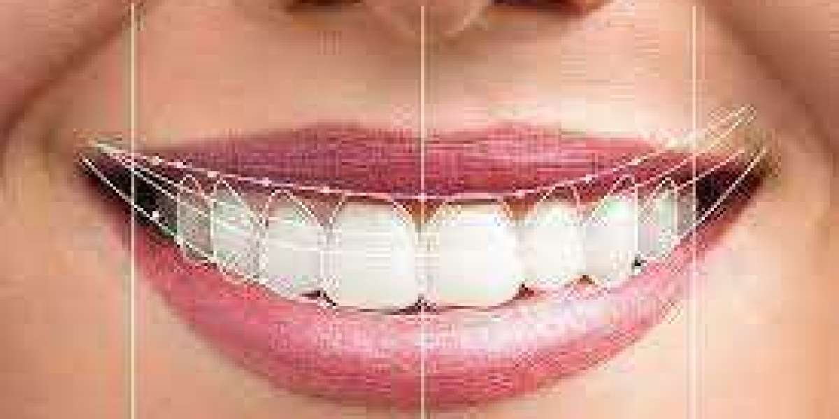 Full Mouth Rehabilitation, The Complete Dental Makeover You Deserve