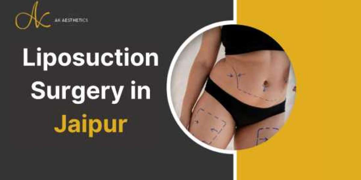 What is The Right Time to Get Liposuction?