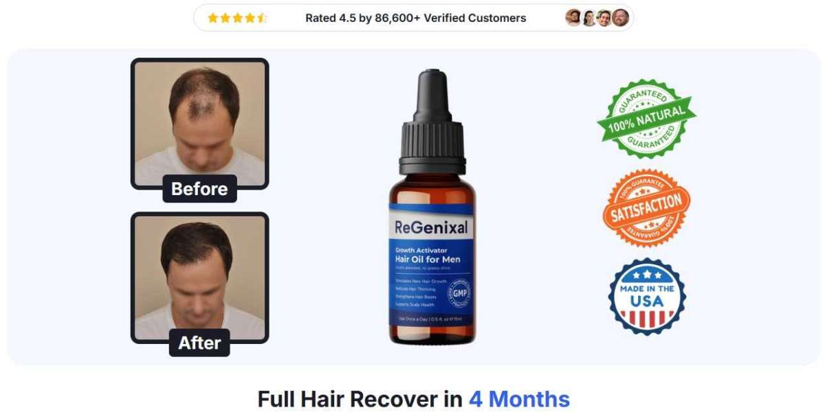 See Ingredients and Uses of Regenixal Hair Regrowth {Official News}