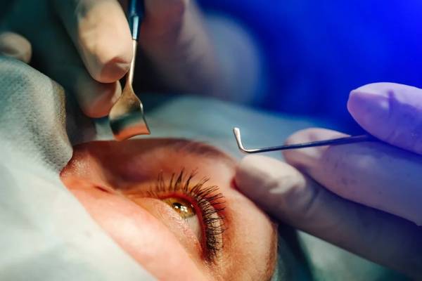 Best Cataract Surgery in Pune, Wakad & Punawale | Clairevision Eye Care