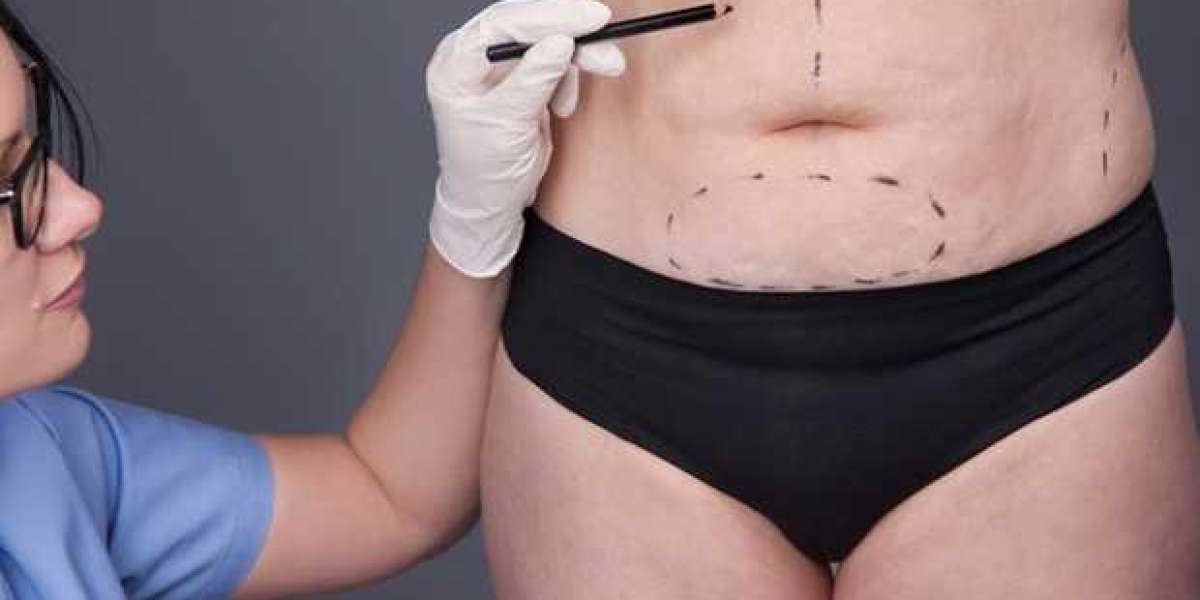 Can You Gain Weight Back After Bariatric Surgery?
