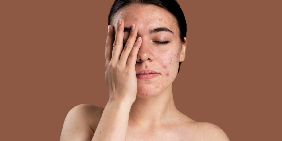 What Makes an Advanced Pigmentation Removal Home Care Kit Truly Effective?