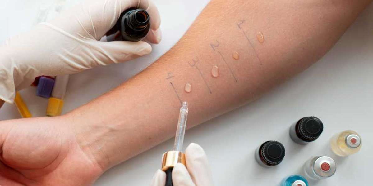 Allergy Diagnostics Market: Factors Behind Market’s Expeditious Growth 2025-2032