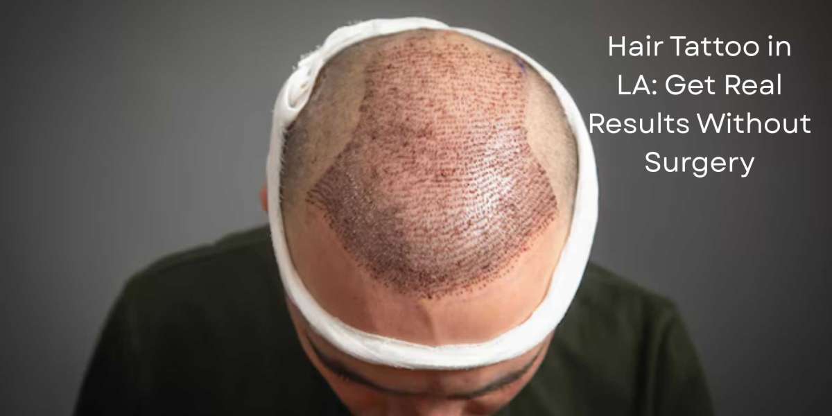 Hair Tattoo in LA: Get Real Results Without Surgery