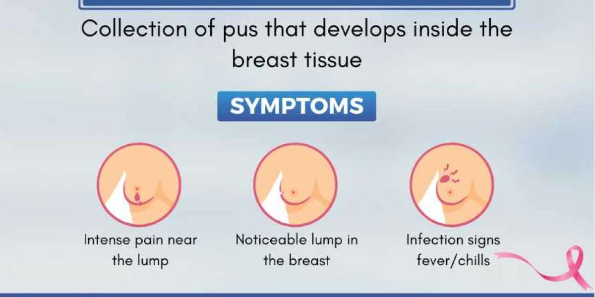 Dr. Shilpy Dolas provides top-rated Breast cancer treatment in Pune