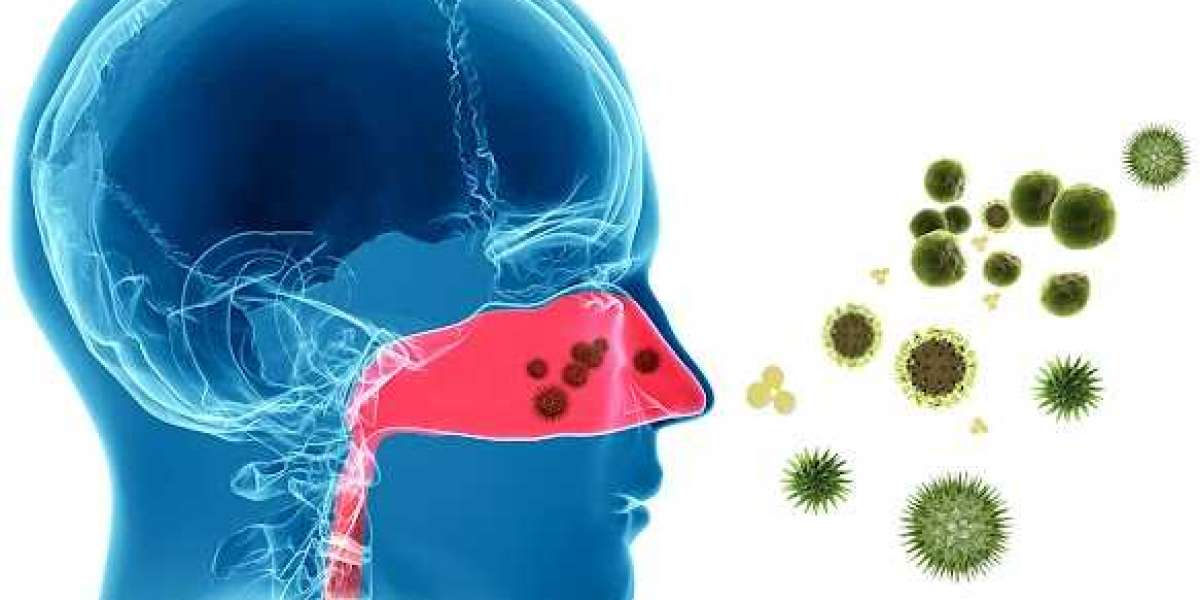 Top Clinic for Sinusitis and Sinus Treatment Gurgaon