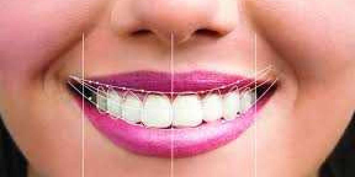 what are the benifits of Smile Designing?