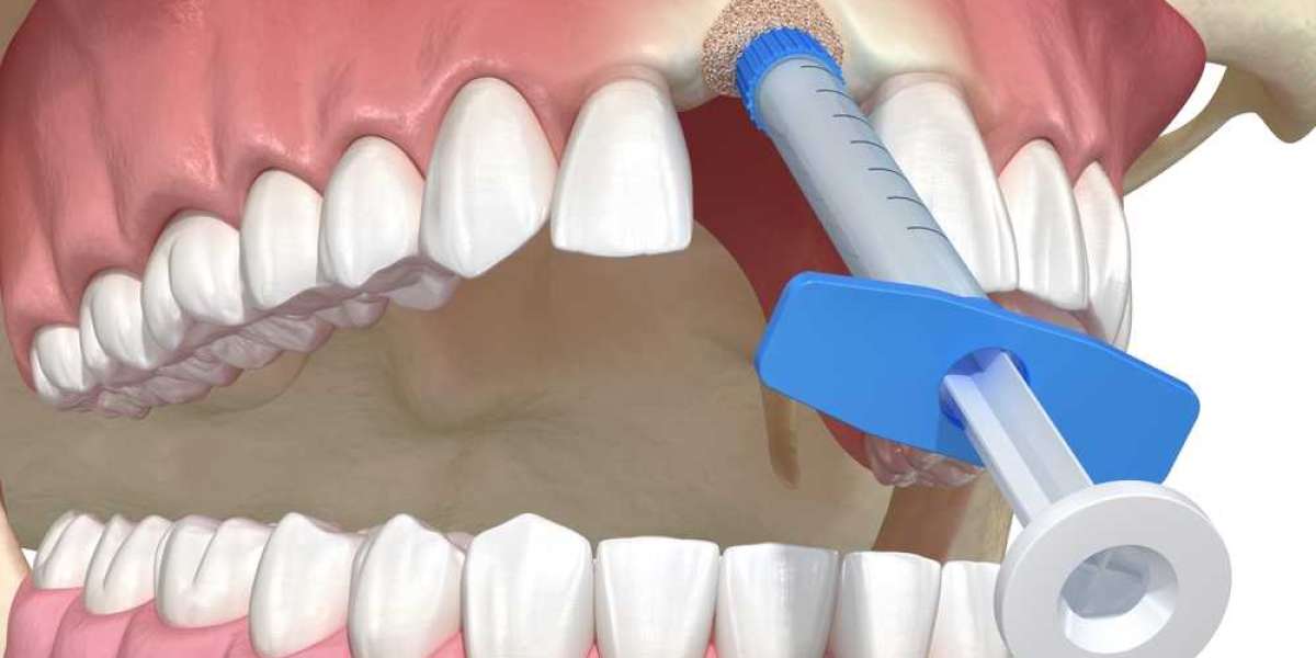 Healing Beyond the Surface: A Journey to Stronger Gums and Bones