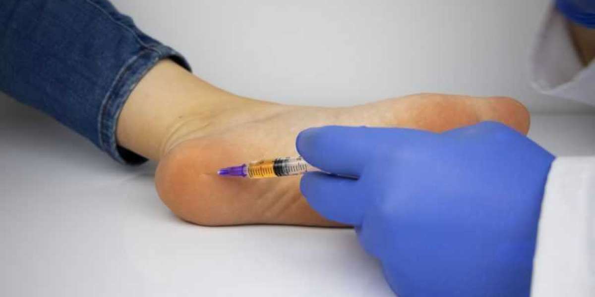 Acute Gout Flare Therapeutics Market to Soar with Innovative Biologics