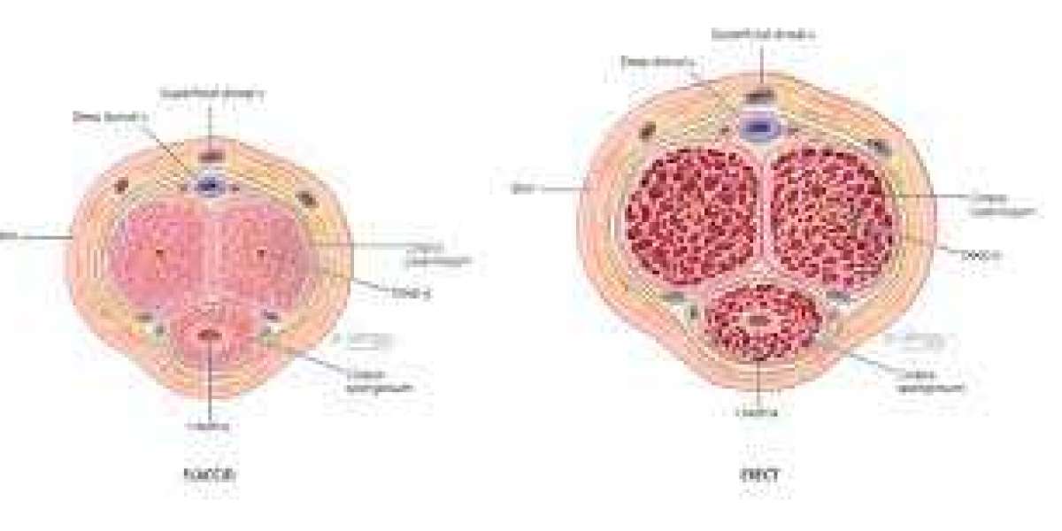 Effective Treatments for Erectile Dysfunction: Boost Your Sexual Performance Naturally