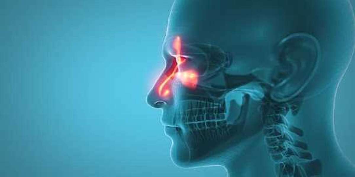 Best Sinus Infection Treatment in Vasant Kunj – Veekay Clinic