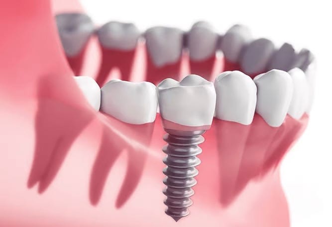 Orthodontist in RR Nagar. Orthodontic care is a long-term… | by Symphonysmiles | May, 2025 | Medium