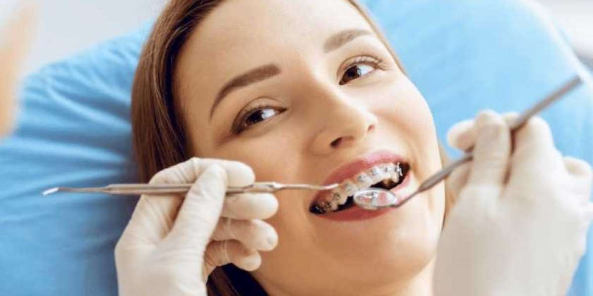 The Science Behind a Perfect Smile: Insights from Orthodontists