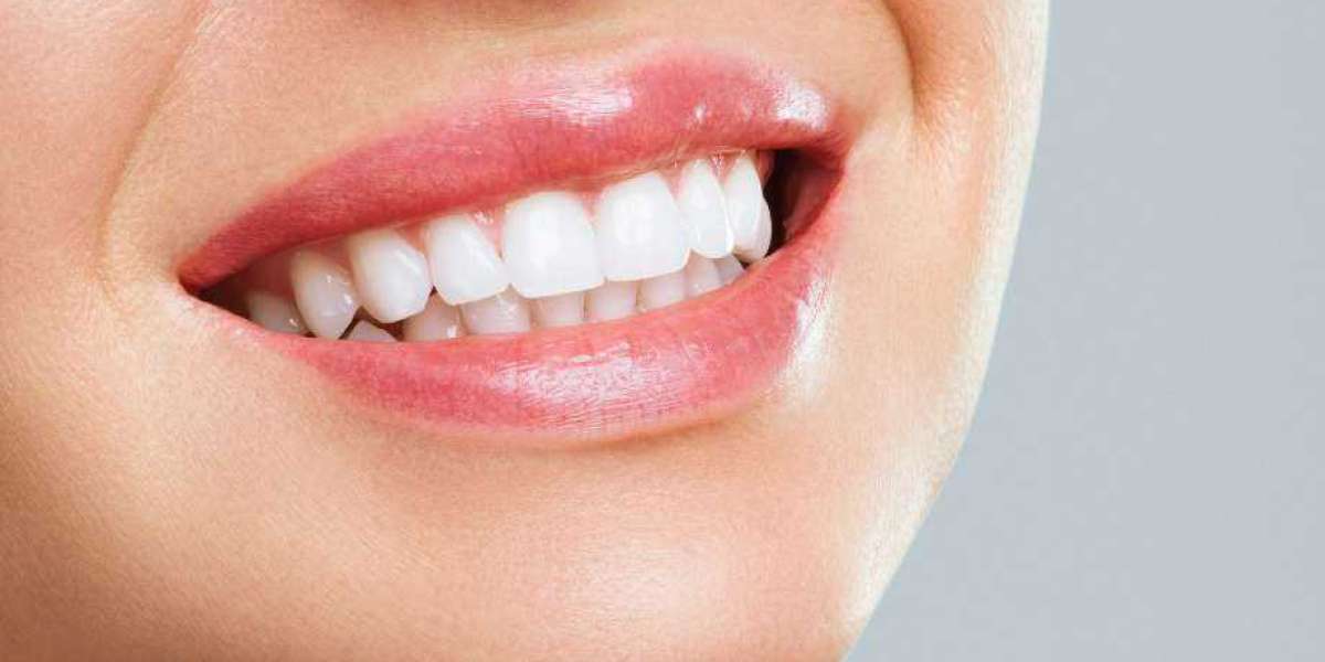 Is Nano Teeth Whitening Suitable for Teens?