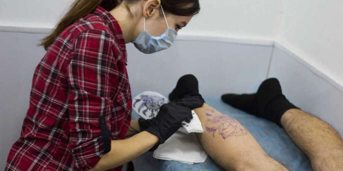 PerfectB Tattoo Removal | Restore Clear Skin with Professional Care