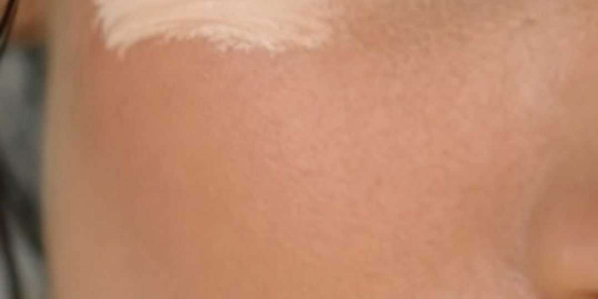 Concealer vs. Foundation: Which One Do You Apply First? | Type Beauty