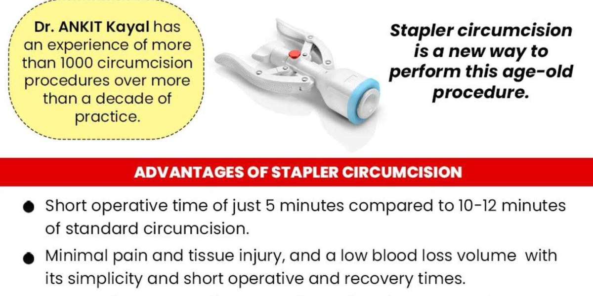 Laser Treatment for Kidney Stones: Is It Right for You?