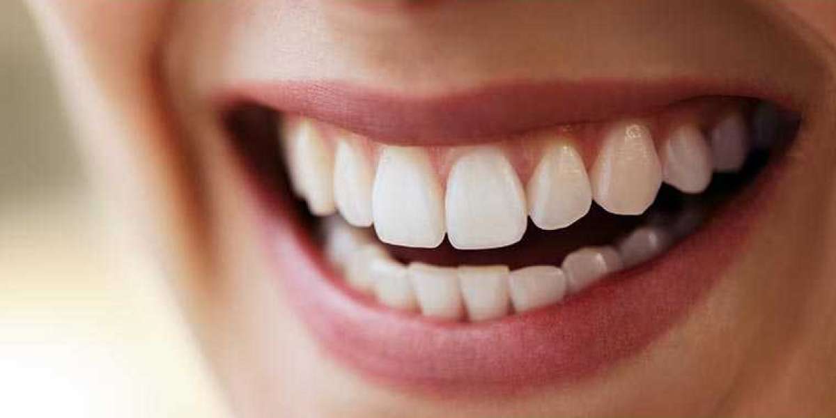 What Happens If You Delay Full Mouth Rehabilitation?