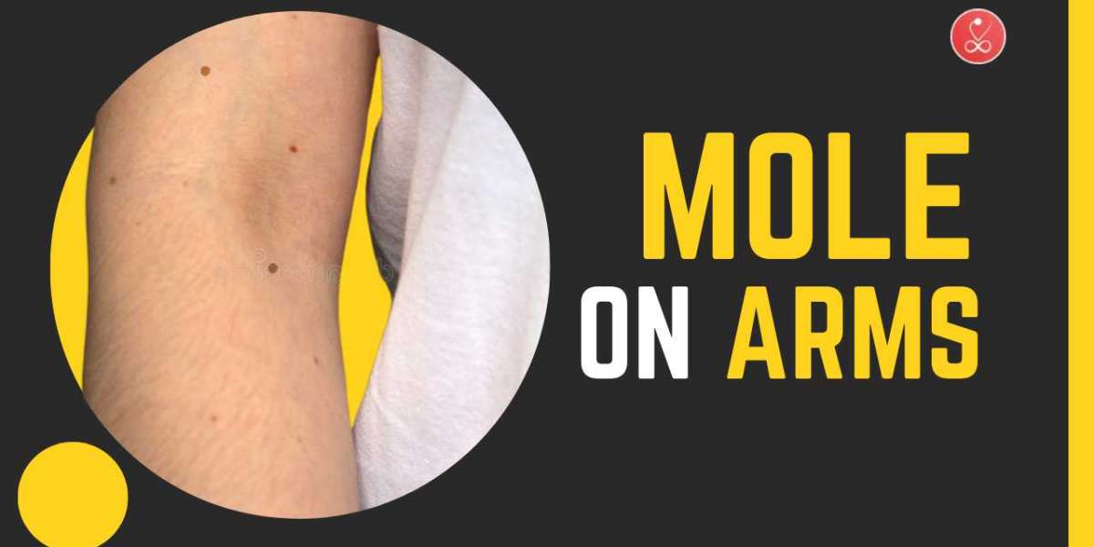 Mole on Arms: Meanings, Health Risks & Spiritual Insights
