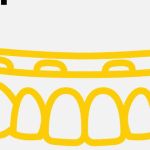 Jos Implant