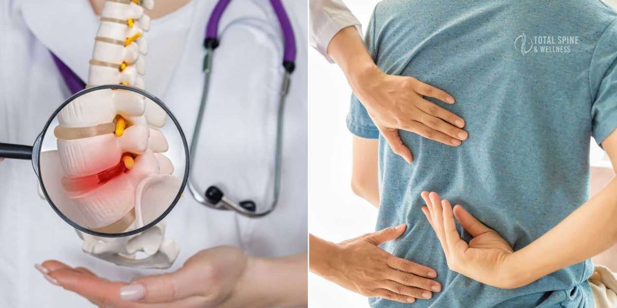 Natural Ways to Regenerate Spinal Discs and Relieve Pain