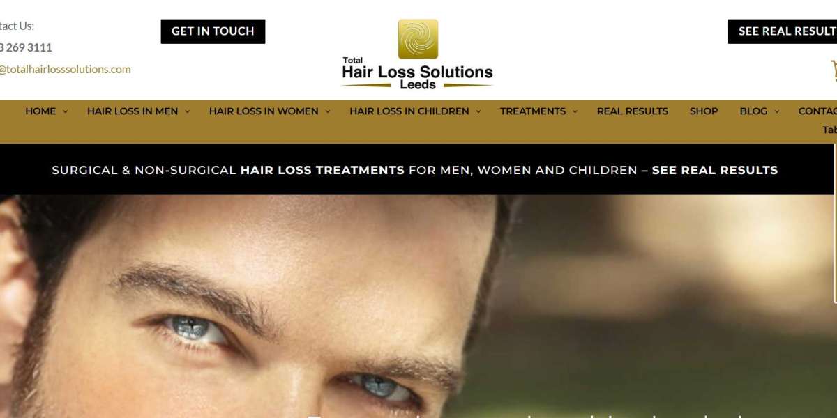 Hair Loss Treatment for Men Near Me – Regain Confidence with the Right Care