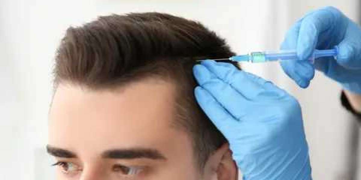 Rediscover Your Confidence: A Guide to Hair Transplant in Dubai