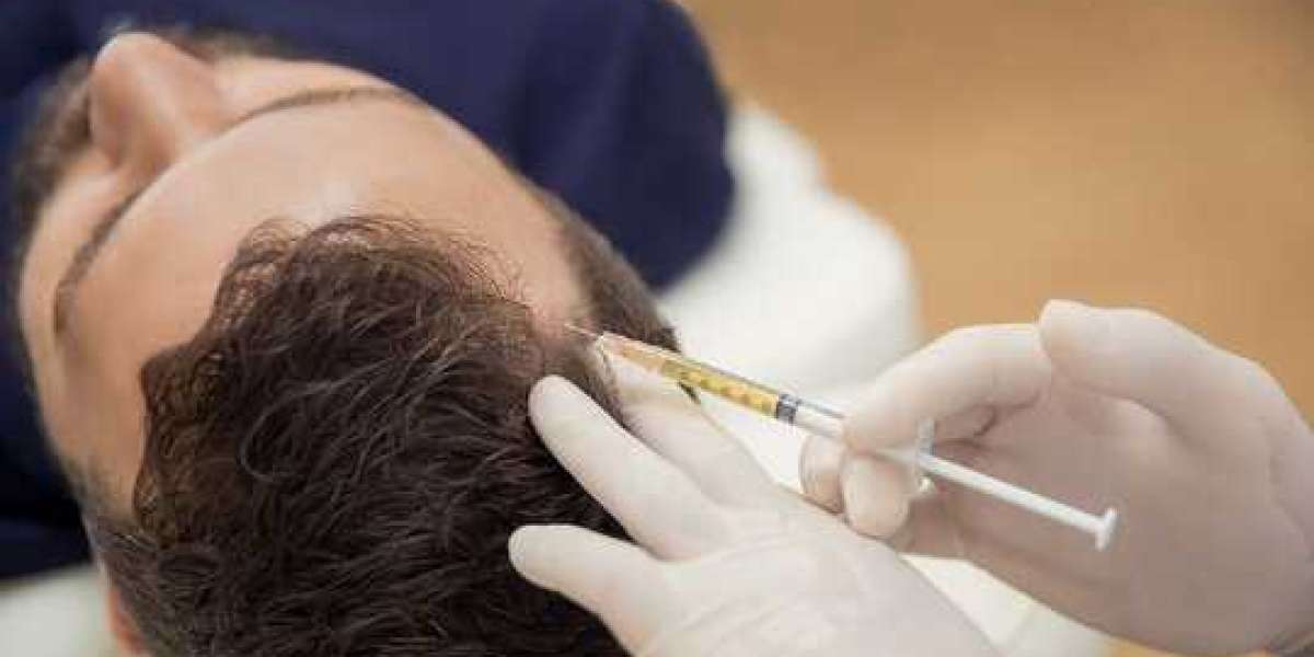 Common Myths vs. Facts About PRP Treatments in Islamabad