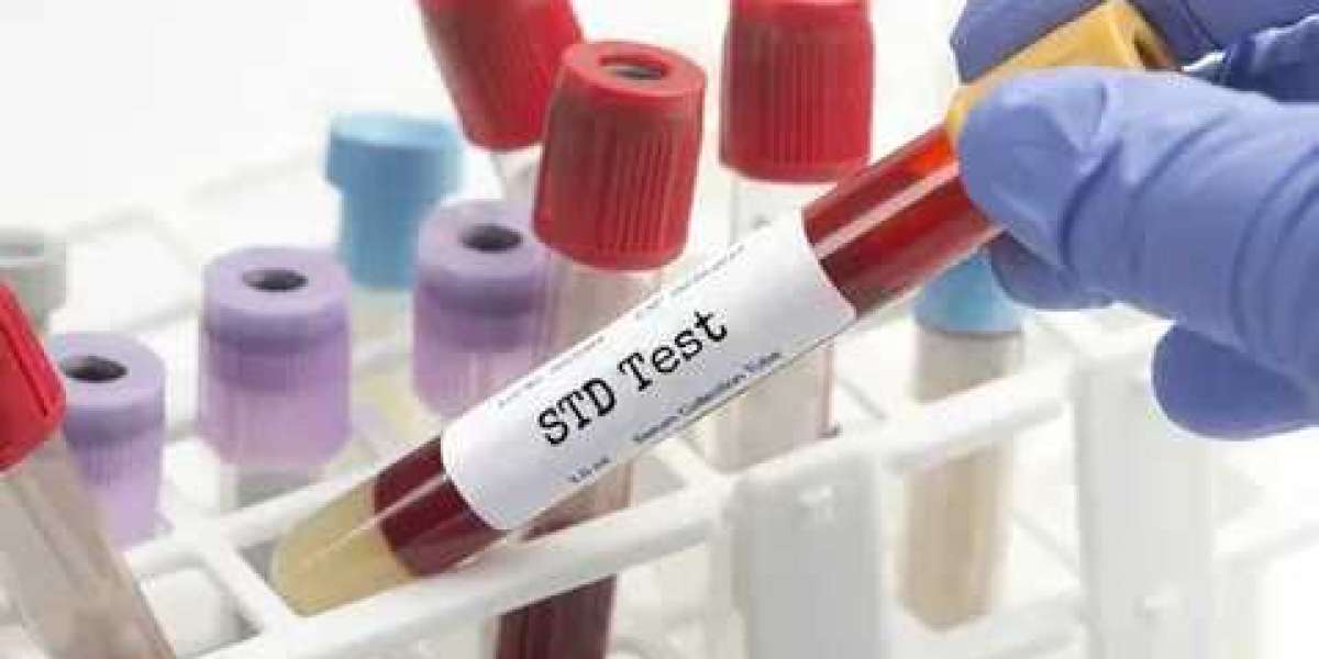 The Role of Regular STD Testing in Preventive Healthcare