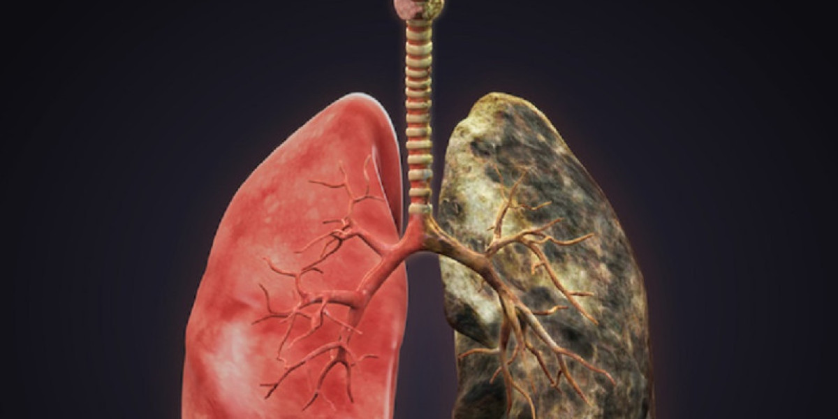 Lung Cancer Screening: Updated ICD-10 Codes & Billing Guide | Best Writes Links