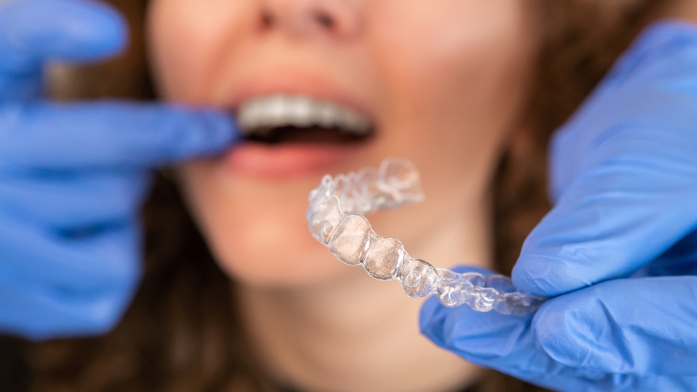 Transform Your Smile with Invisalign & Orthodontist in Hamilton