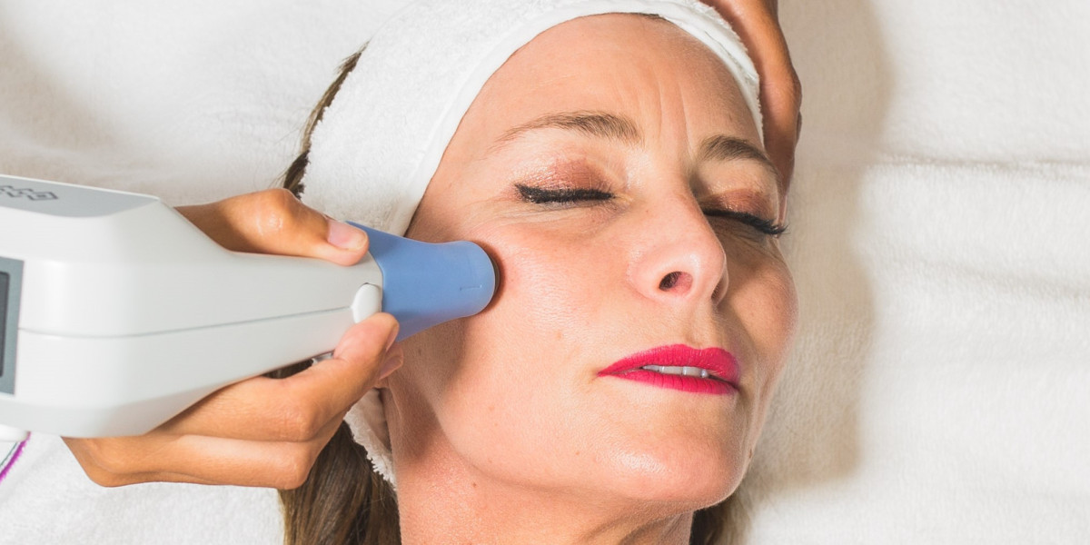Does Exilis Effectively Reduce Fine Lines and Wrinkles?