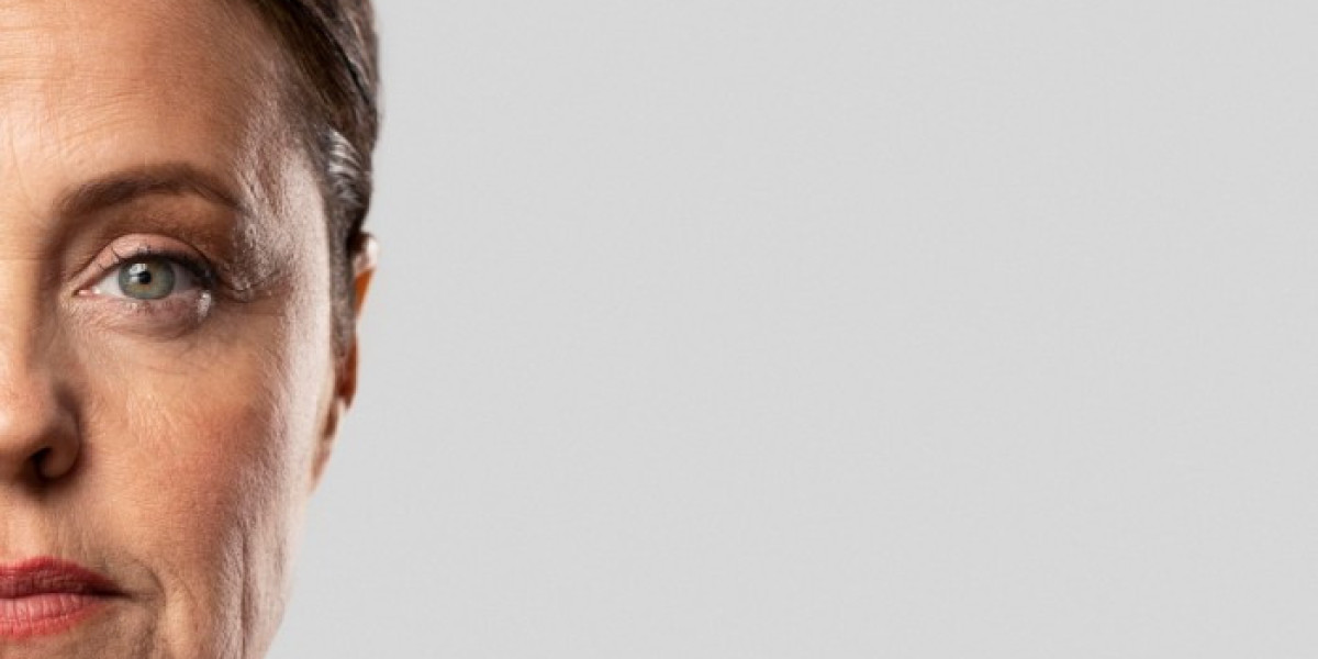 Wrinkles on Face Explained: From Early Signs to Lasting Solutions