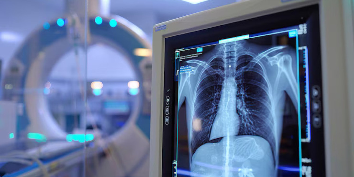 Comprehensive Guide to Radiology Test and Services in Kokapet: What You Need to Know