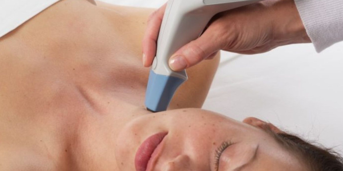 How Safe Is Exilis Treatment for Skin Tightening?