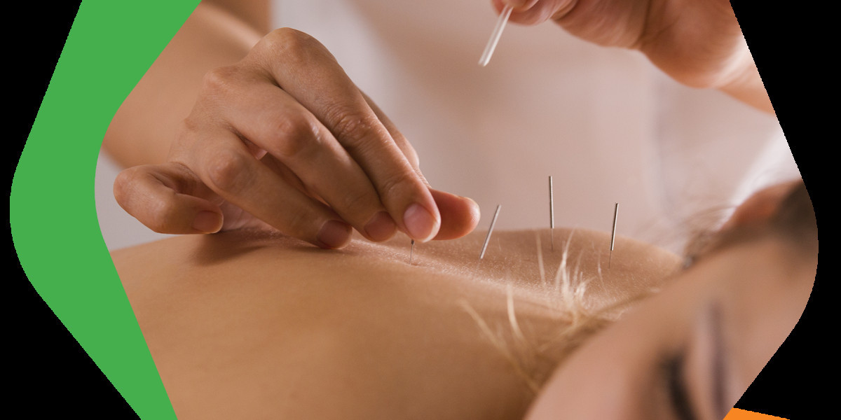 Discover Trusted Traditional Chinese Medicine in Calgary with Sincere Clinic