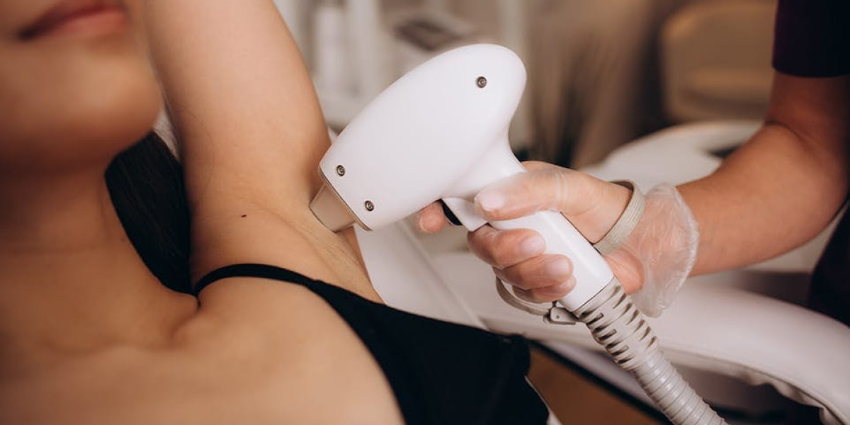 Is Laser Hairs Removal a Permanent Hair Solution?